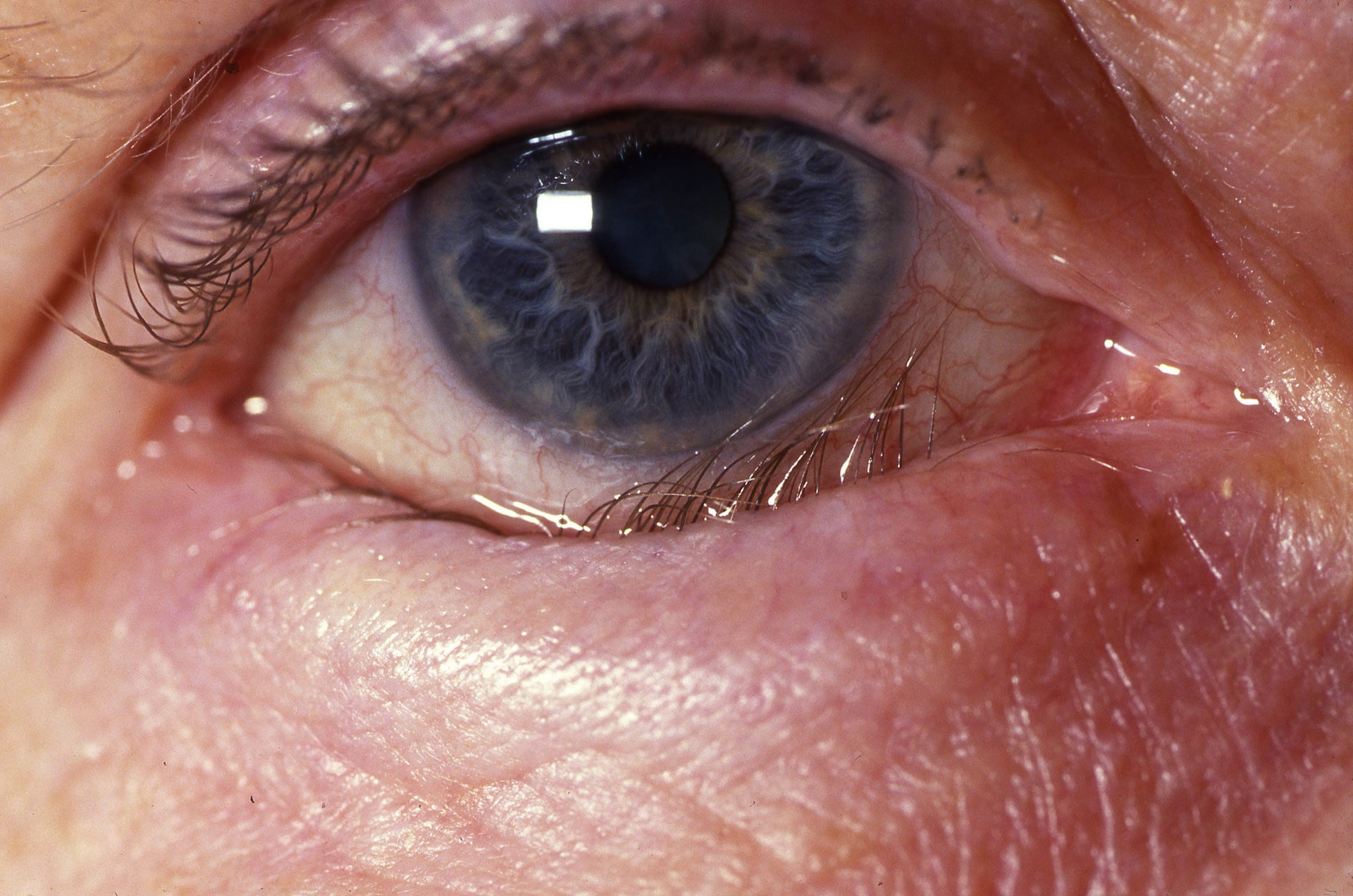 close up image of a person's eye