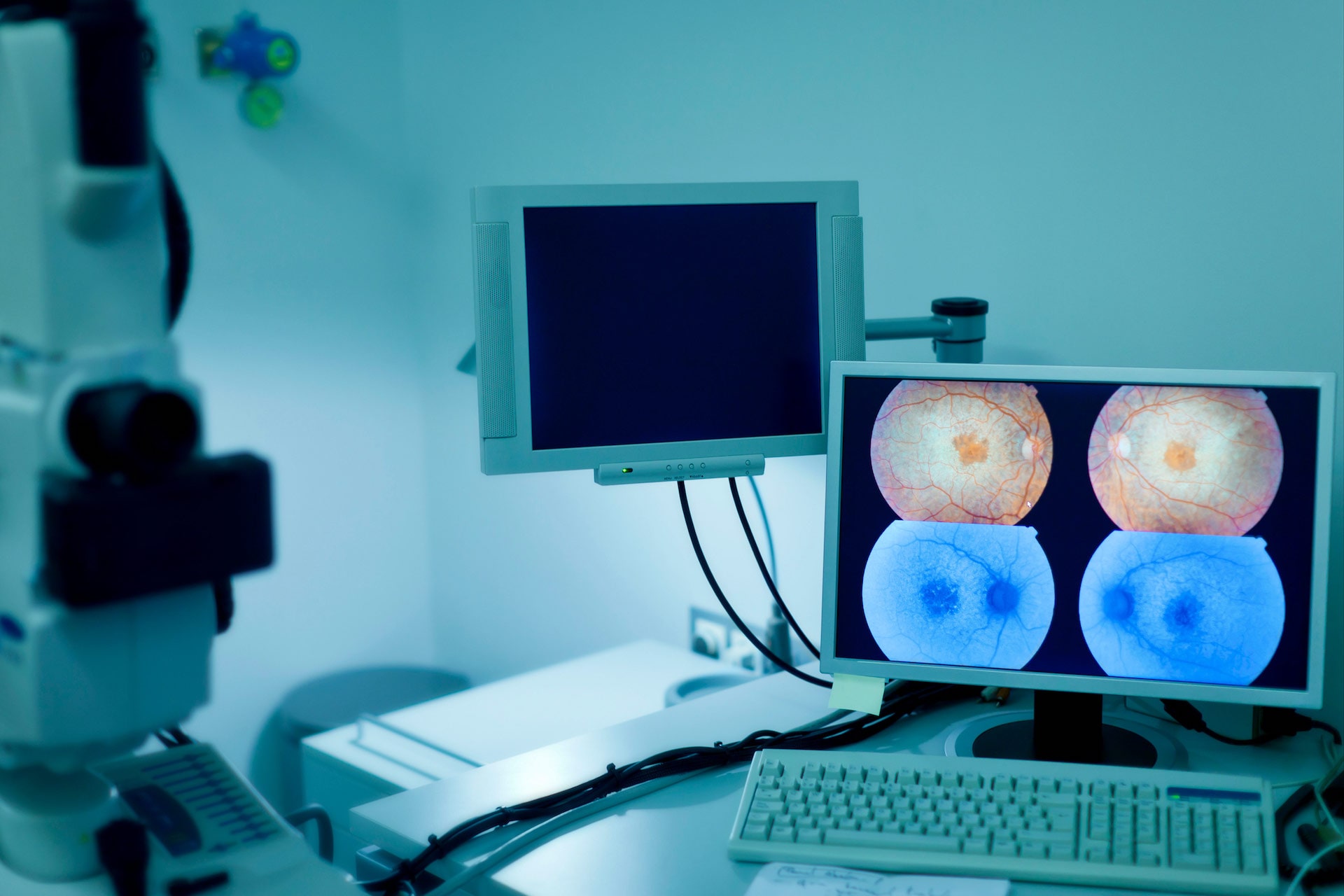 image of medical computers depicting a patient's retina